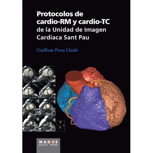 Protocolos de cardio-RM y cardio-TC de la Unidad de Imagen Cardiaca Sant Pau