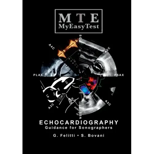 Echocardiography - MyEasyTest