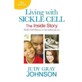 Living With Sickle Cell - The Inside Story: Sickle Cell Disease is Not What You See