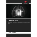 Chest X-ray