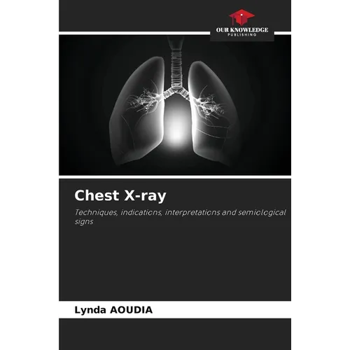 Chest X-ray
