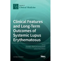 Clinical Features and Long-Term Outcomes of Systemic Lupus Erythematosus