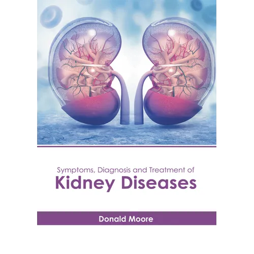 Symptoms, Diagnosis and Treatment of Kidney Diseases