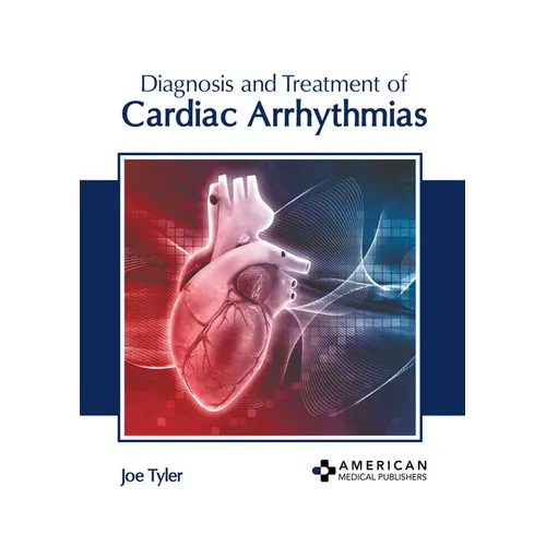 Diagnosis and Treatment of Cardiac Arrhythmias