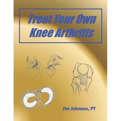 Treat Your Own Knee Arthritis