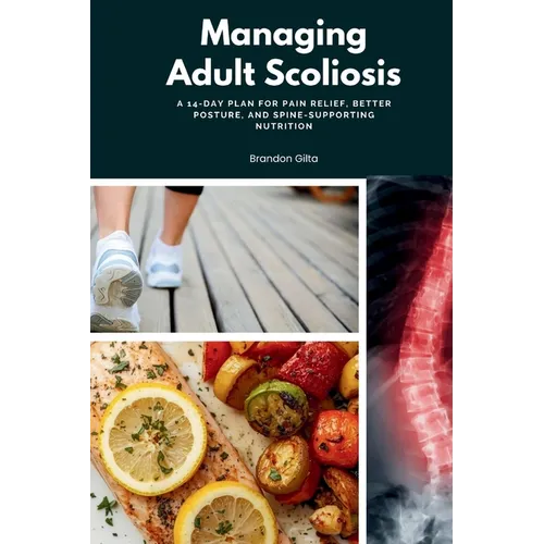 Managing Adult Scoliosis: A 14-Day Plan for Pain Relief, Better Posture, and Spine-Supporting Nutrition
