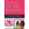 Why Is My Skin Brown?