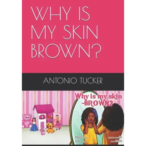 Why Is My Skin Brown?