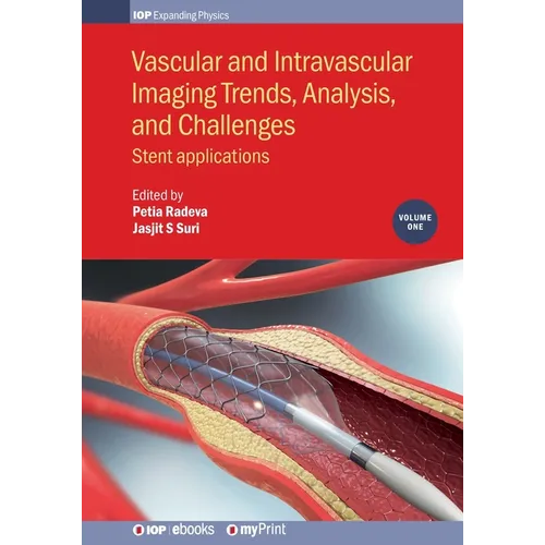 Vascular and Intravascular Imaging Trends, Analysis, and Challenges, Volume 1: Stent applications