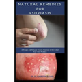 Natural Remedies for Psoriasis: A Simple and Natural Proven Solution to Get Rid of Your Skin Problem: Dermatitis, Eczema, Psoriasis & Rosacea and Othe