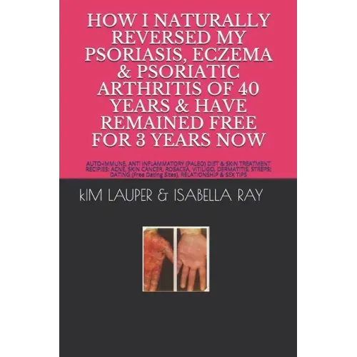 How I Naturally Reversed My Psoriasis, Eczema and Psoriatic Arthritis of 40 Years and Have Remained Free for 3 Years Now: AUTO IMMUNE, GLUTEN FREE, DA