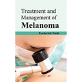 Treatment and Management of Melanoma