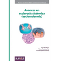 Avances en esclerosis sistémica (esclerodermia)
