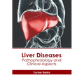 Liver Diseases: Pathophysiology and Clinical Aspects