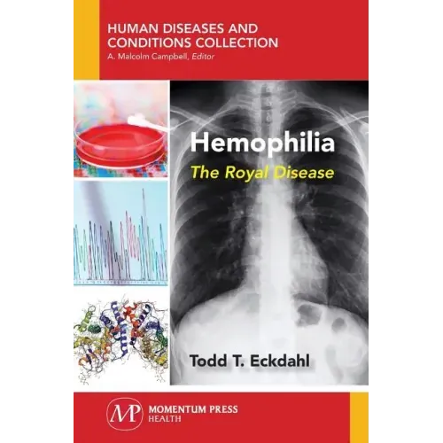 Hemophilia: The Royal Disease
