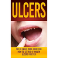 Ulcers: The Ultimate Cure Guide for How to Get Rid of Mouth Ulcers Instantly