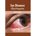 Eye Diseases: Clinical Perspectives