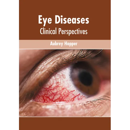Eye Diseases: Clinical Perspectives
