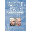 Face the Facts: The Truth About Facial Plastic Surgery Procedures That Do and Don't Work