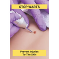 Stop Warts: Prevent Injuries To The Skin: Warts Treatment Near Me