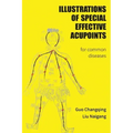 Illustrations Of Special Effective Acupoints for common Diseases