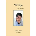 Vitiligo
