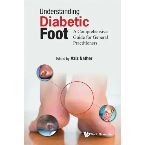 Understanding Diabetic Foot: A Comprehensive Guide for General Practitioners
