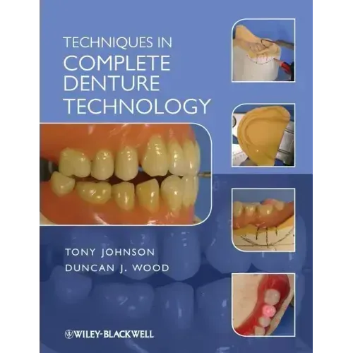 Techniques in Complete Denture