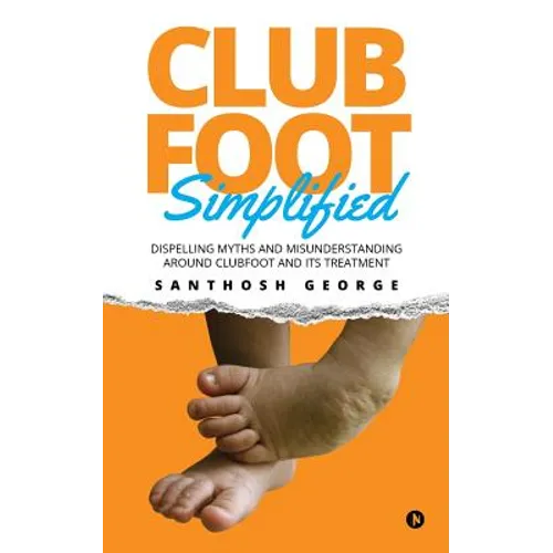 Clubfoot Simplified: Dispelling Myths and Misunderstanding around Clubfoot and its treatment