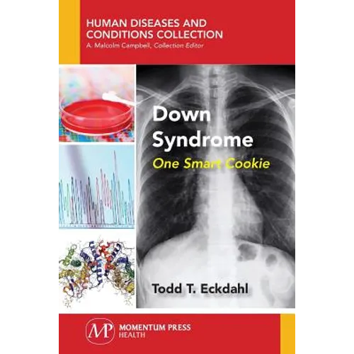Down Syndrome: One Smart Cookie