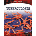 Tuberculosis