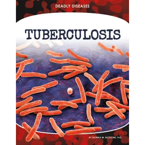 Tuberculosis