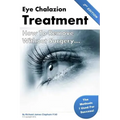 Eye Chalazion: How To Remove Without Surgery: My personal experience and the methods I used for success