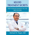 Keloid Treatment Secrets: What Your Doctor Wont Tell You.
