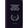 The Pathology and Treatment of Stricture of the Urethra, Both in the Male and Female