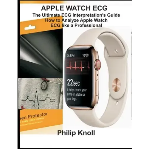 Apple Watch ECG: The Ultimate ECG Interpretation Guide; How to Analyze Apple Watch ECG Like a Professional