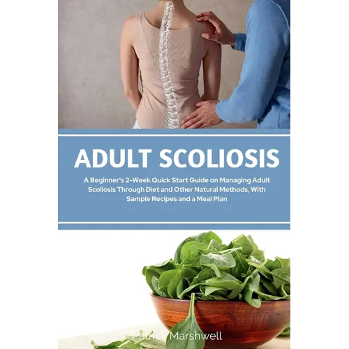 Adult Scoliosis: A Beginner's 2-Week Quick Start Guide on Managing Adult Scoliosis Through Diet and Other Natural Methods, With Sample Recipes and a M
