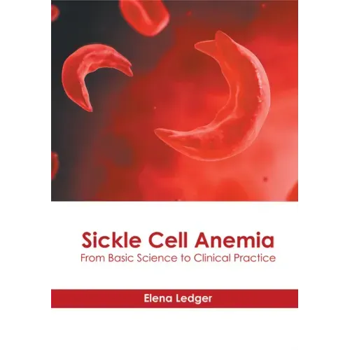 Sickle Cell Anemia: From Basic Science to Clinical Practice