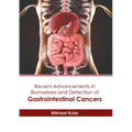 Recent Advancements in Biomarkers and Detection of Gastrointestinal Cancers