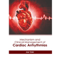 Mechanism and Clinical Management of Cardiac Arrhythmias