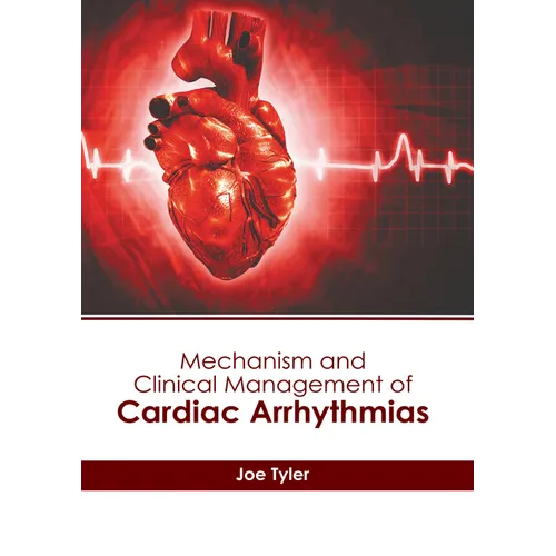 Mechanism and Clinical Management of Cardiac Arrhythmias