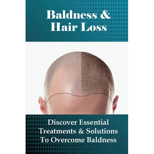 Baldness & Hair Loss: Discover Essential Treatments & Solutions To Overcome Baldness: How To Prevent Hair Loss For Guys