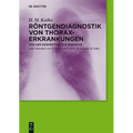 Röntgendiagnostik von Thoraxerkrankungen