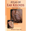 Atlas of Ear Keloids