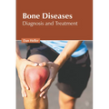 Bone Diseases: Diagnosis and Treatment
