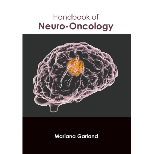 Handbook of Neuro-Oncology