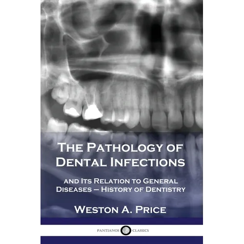 The Pathology of Dental Infections: and Its Relation to General Diseases - History of Dentistry