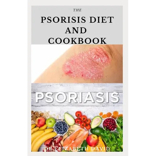 The Psoriasis Diet and Cookbook: Dietary Guide For Preventing and Healing Psoriasis: Includes Delicious Recipe, Meal Plan and Cookbook