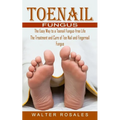 Toenail Fungus: The Easy Way to a Toenail Fungus-free Life (The Treatment and Cure of Toe Nail and Fingernail Fungus)