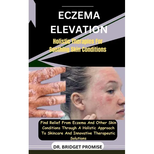 Eczema Elevation: Holistic Therapies For Soothing Skin Conditions: Find Relief From Eczema And Other Skin Conditions Through A Holistic